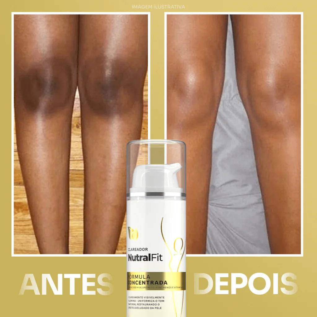 depois 1